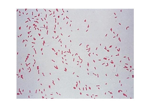 Pseudomonas spp. Синегнойная палочка чистая культура. Pseudomonas aeruginosa (синегнойная палочка). Pseudomonas aeruginosa микроскопия. Pseudomonas aeruginosa микробиология.