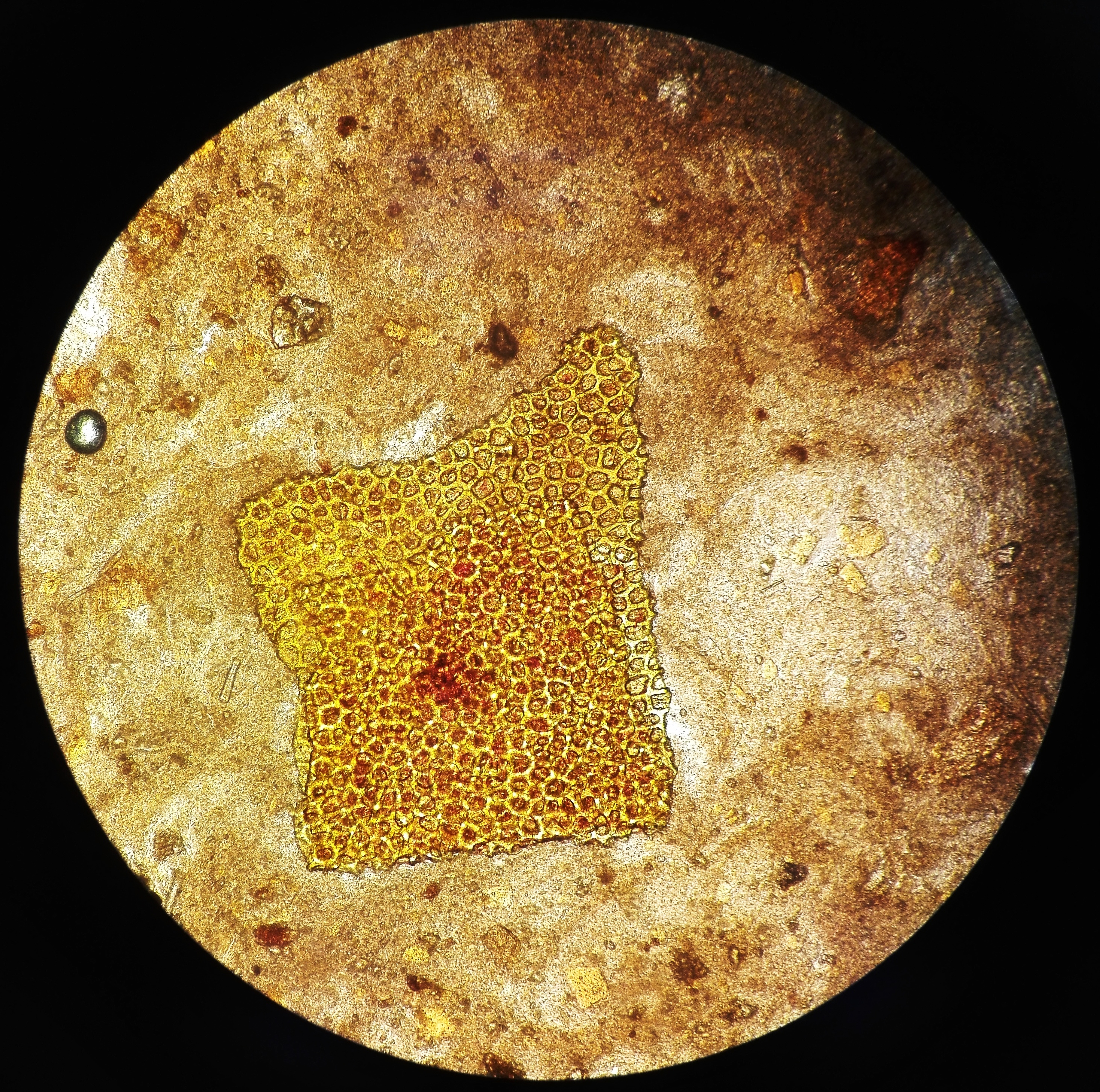 Растительная клетчатка в копрограмме. Микроскопия кала клетчатка. Микроскопия кала переваримая клетчатка. Микроскопия кала растительная клетчатка. Переваренная клетчатка микроскопия.