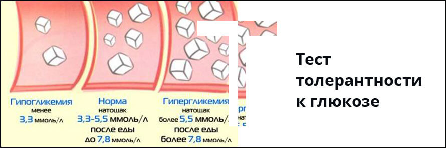 Картинки глюкозотолерантный тест