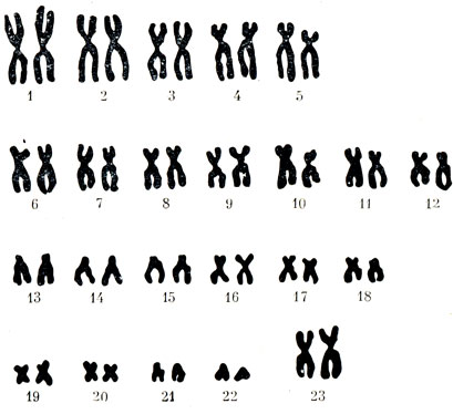 Кариограмма графическое изображение кариотипа то есть числа. Хромосомный набор (кариотип) человека (женский). Хромосомный набор кариотип человека рисунок. Кариотип человека схема. Кариотип человека. Набор хромосом женщины.