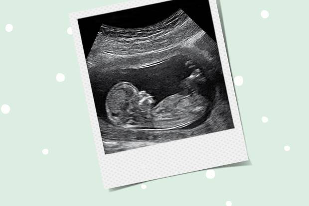Шевеления на 13 неделе. 13 Акушерская неделя беременности УЗИ. 13 Недель беременности симптомы беременности. Плод 12-13 недель беременности. Малыш на 13 неделе беременности.