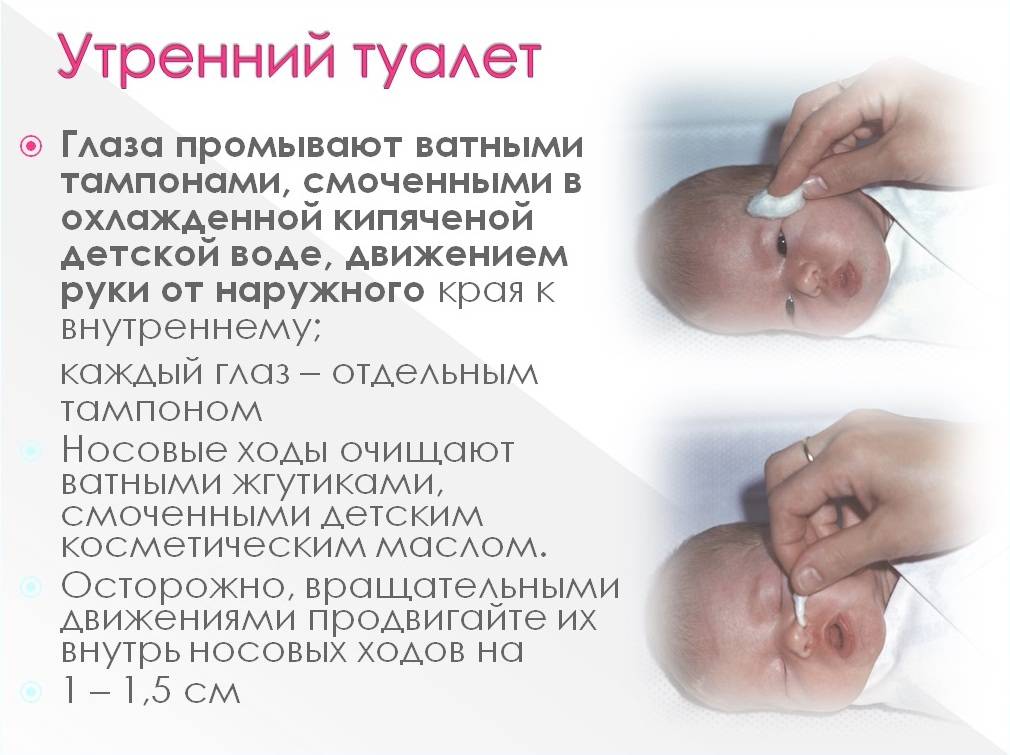 Проведение утреннего туалета новорожденному ребенку. Проведение утреннего туалета новорожденного алгоритм. Утренний туалет новорожденного алгоритм. Обработка носа новорожденных алгоритм. Обработка глаз новорожденного алгоритм.