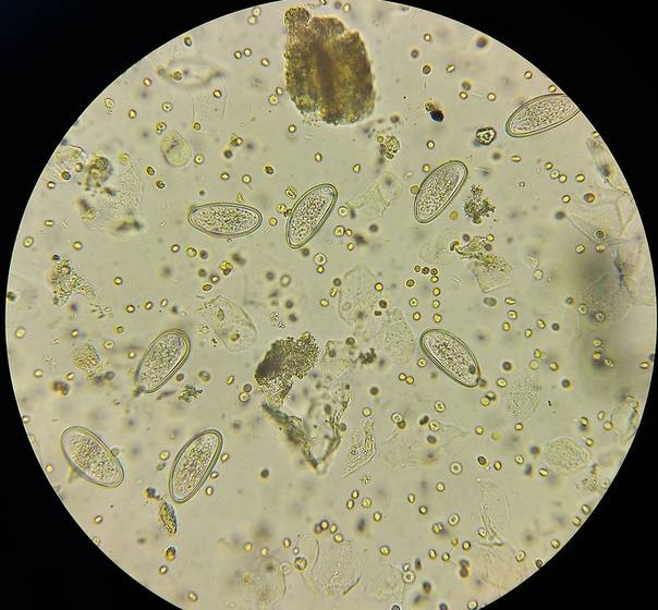 Копрограмма микроскопия атлас фото