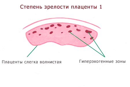 Степень зрелости плаценты 37 недель. 1 Степень созревания плаценты. Степень зрелости плаценты 3. Степени старения плаценты по неделям норма. Структурность плаценты 1 степени.