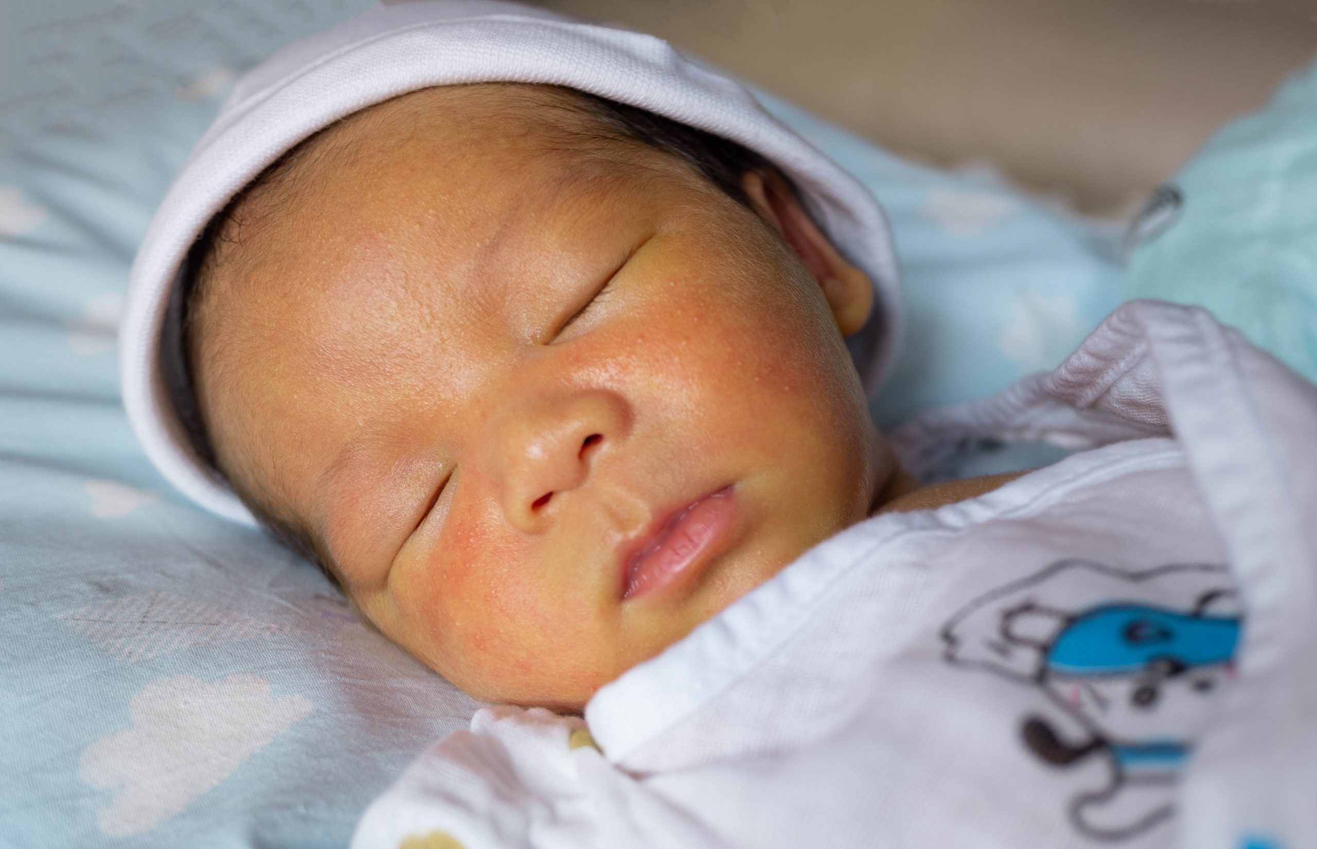 Желтушка у новорожденных. Цвет кожи новорожденного ребенка. Желтуха у новорожденных фото. Желтуха новорожденных отзывы