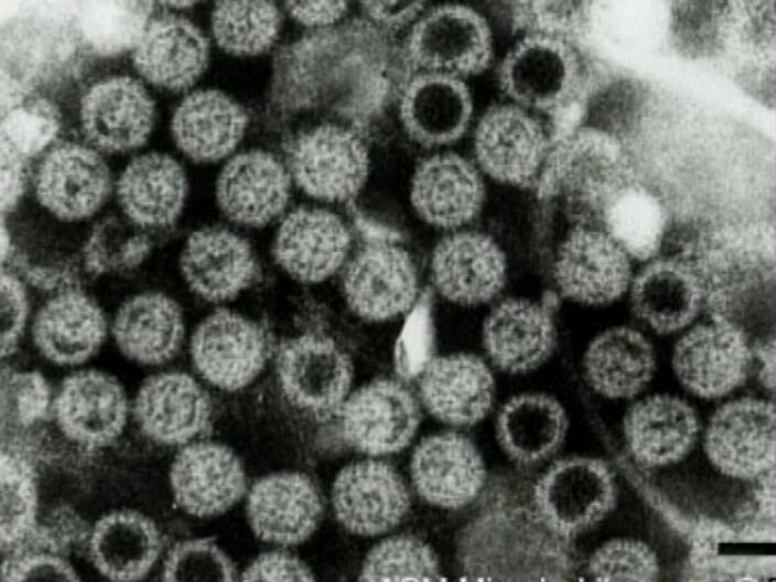 Ротавирусный энтерит. Вирус ротавирус под микроскопом. Ротавирус микроскопия. Ротавирусная инфекция под микроскопом. Ротавирус под микроскопом.