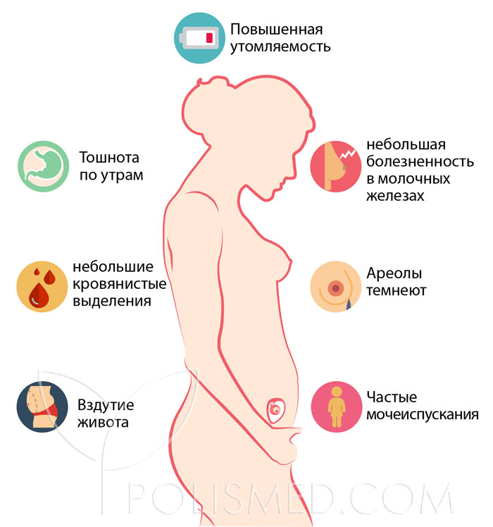 Боли на раннем сроке. Симптомы беременности на 2 недели. Симптомы 2 недельной беременности. Признаки беременности на первой неделе. Симптомы беременности на 2 недели беременности.