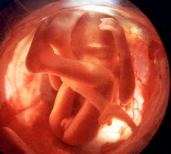 Как выглядят 26 недели беременности. Плод 6 месяцев в утробе.