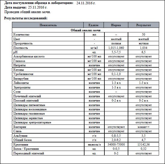 Лейкоциты качественно в моче обнаружено что это. Лейкоциты в моче Leu. Лейкоциты в анализе мочи 3+. Лейкоциты в моче лей/мл норма. Анализ мочи в норме лейкоциты в мкл.