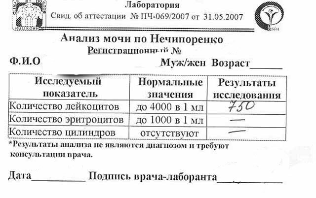 Что такое моча по нечипоренко – Анализ мочи по Нечипоренко — как собирать, норма, расшифровка