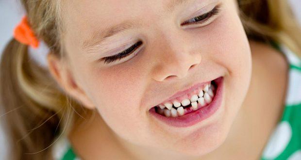 Есть ли корень у молочного зуба – Есть ли корни у молочных зубов: остаются в десне, рассасываются