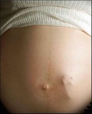 Пять месяцев беременности фото живота – 5 : ,
