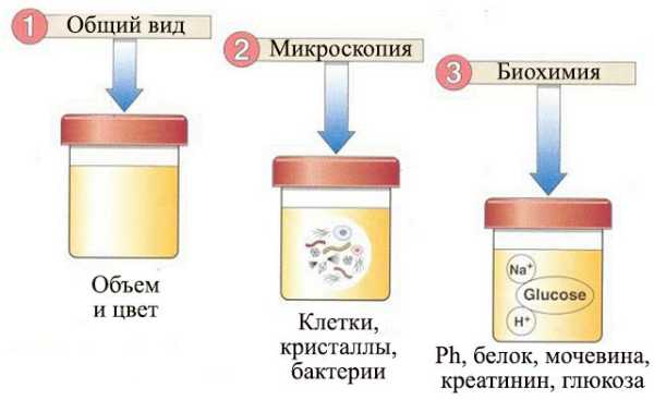 Общий анализ мочи картинка