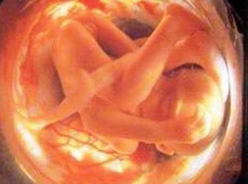 30 недель беременности что происходит с мамой. Плод на 31 неделе беременности. Малыш в утробе 32 неделе беременности. Малыш на 31 неделе беременности. Ребёнок 30 неделя беременности в утробе.