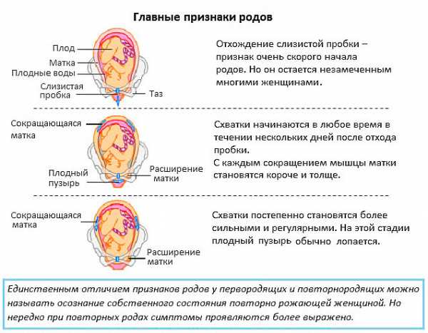 Этапы родов с картинками