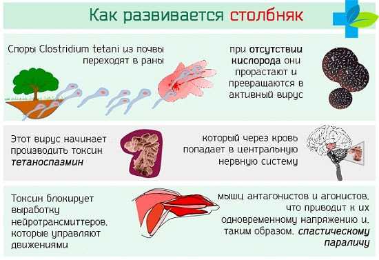 Схема вакцинации дифтерия коклюш столбняк