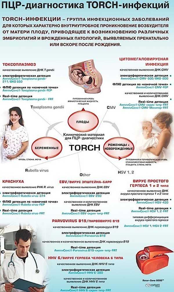 Торч инфекции презентация