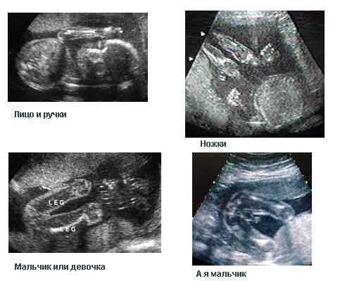 Ребенок в 22 недели беременности размер плода фото узи
